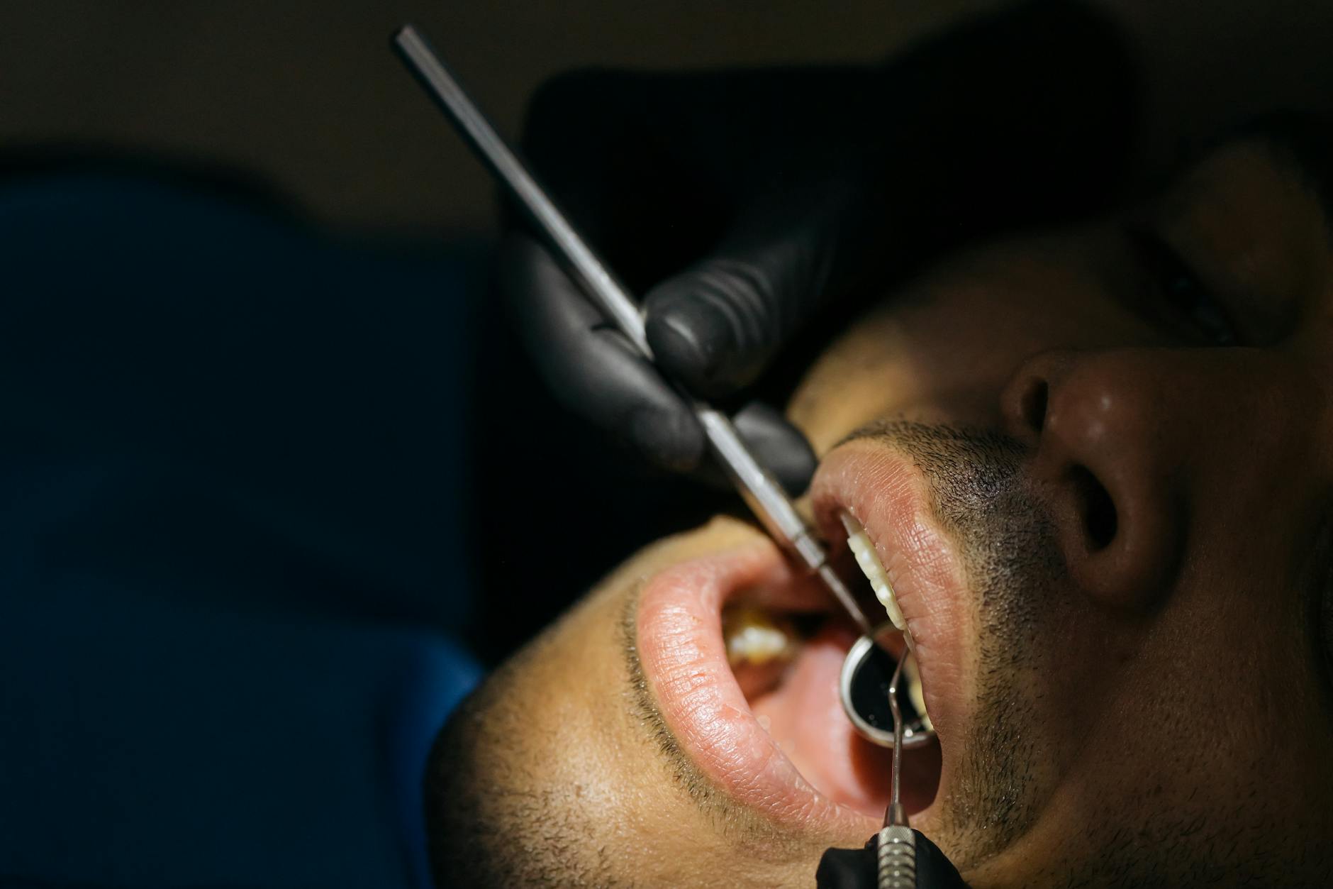 close up shot of a man having dental checkup